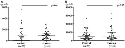 TGF-β Concentration in Breast Milk is Associated With the Development of Eczema in Infants